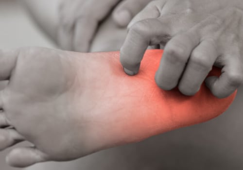 What are the stages of neuropathy?